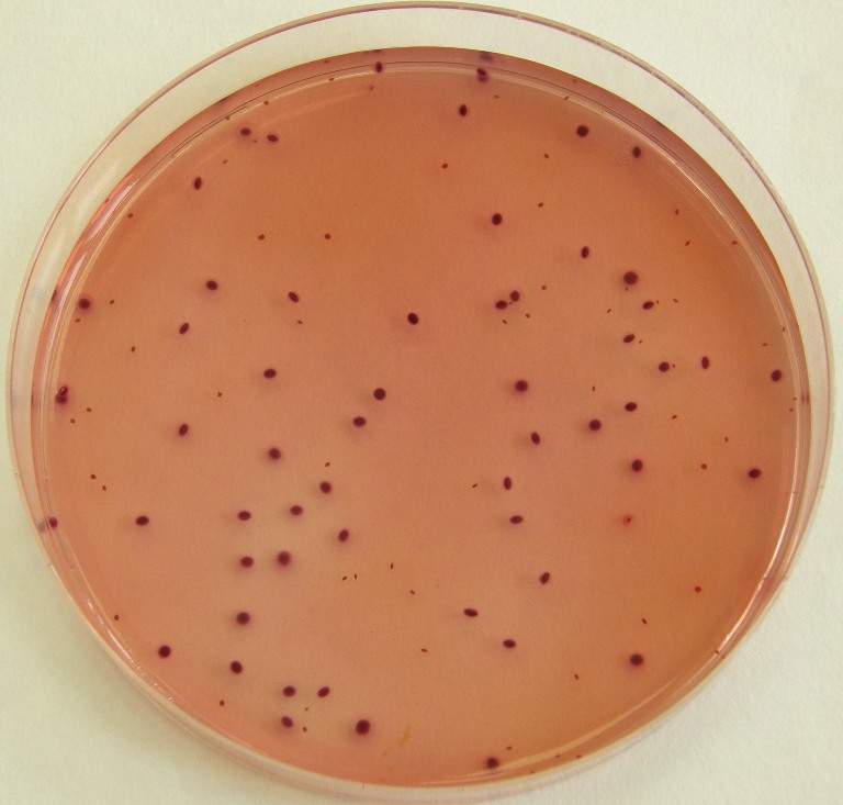 Enterobacteriaceae na VČŽG