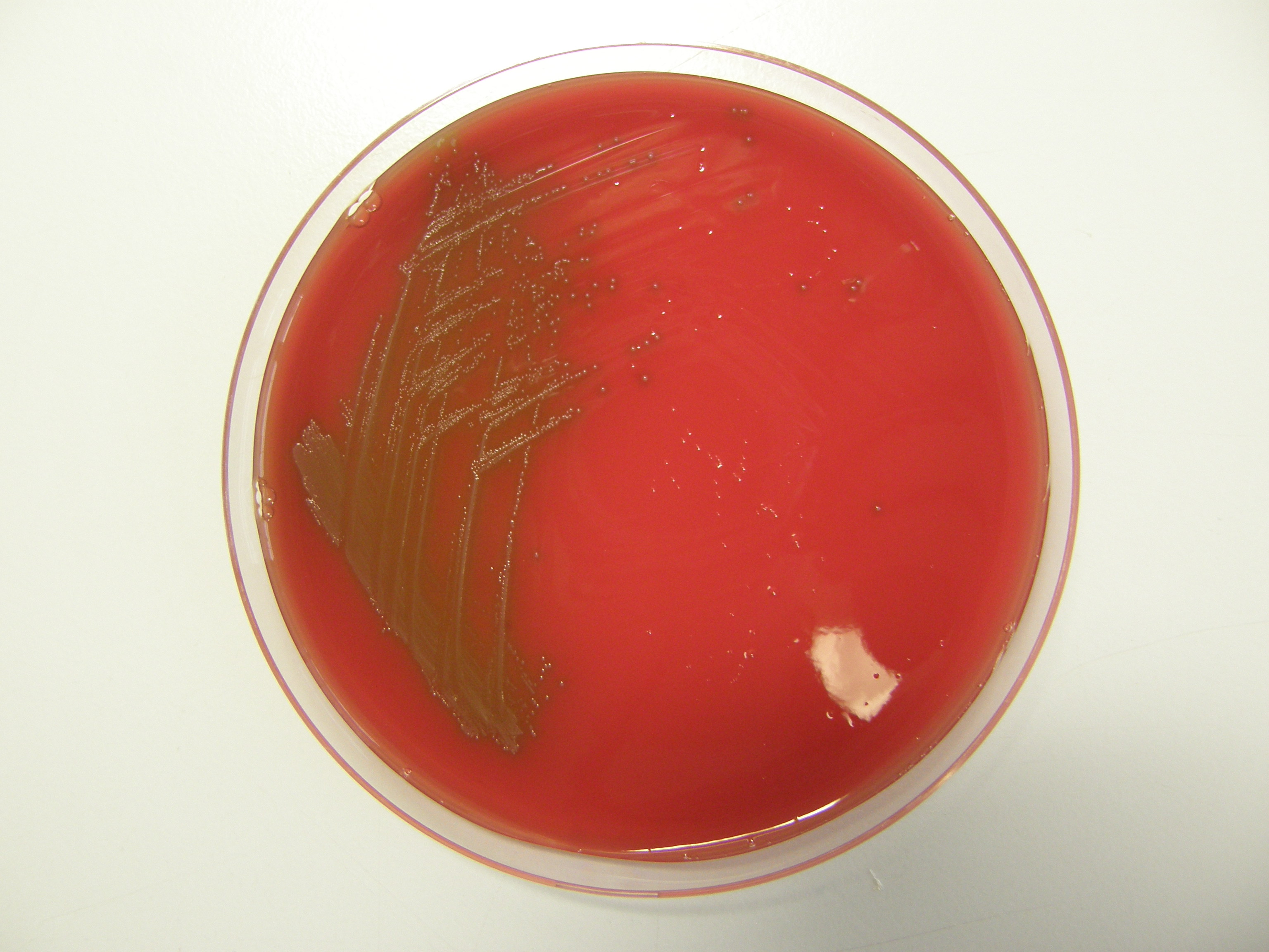 Enterococcus rafinosus