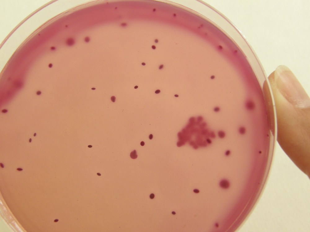 Koliformní bakterie na VČŽL